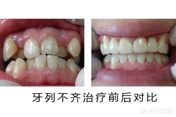 金华最新24小时牙医在线咨询方法分析(最方便真实的金华有没有24小时牙医方法)